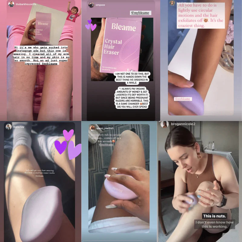 Crystal Hair Eraser - Buy 1 get 2 FREE